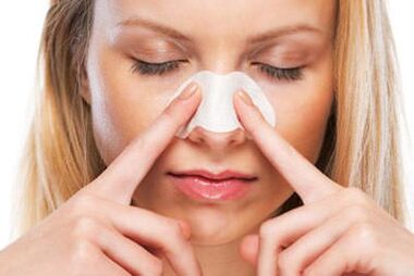 Rhinoplasty of the nose
