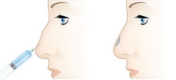 The procedure allows you to adjust various problems