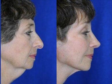 Great nostrils