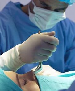 perform closed nose plastic surgery