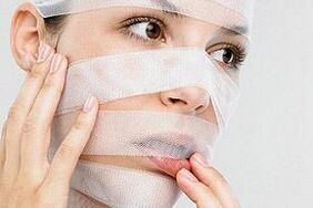 girl in bandages after rhinoplasty